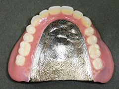 患者様や歯科医院様のニーズにお応えできる「金属床義歯」