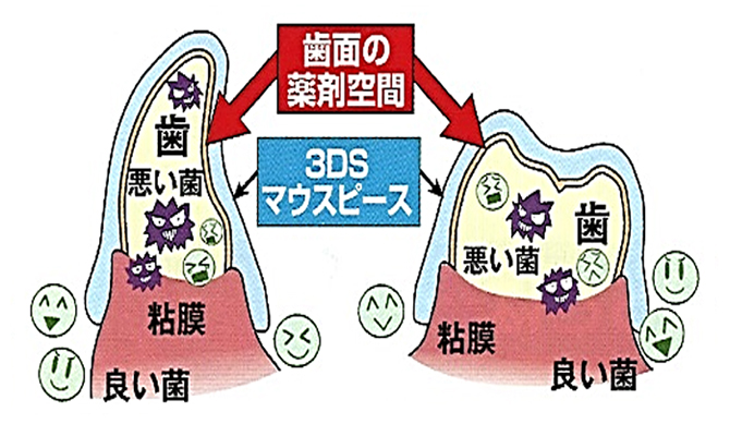 3DS療法とは