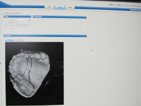 SensAble（SensAble Dental Lab System）