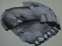 SensAble（SensAble Dental Lab System）